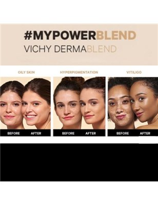 Vichy Dermablend Fond Teint Base Fluida Cor 45 Gold 30ml